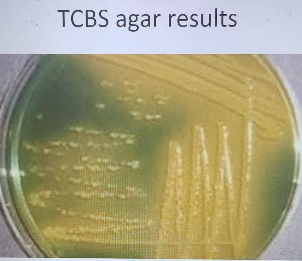 TCBS agar results MacConkey Agar results 3 4 (cm) 5 | Chegg.com