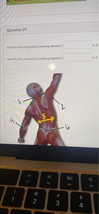 Question 25 Identify the anatomical marking labeled 1 | Chegg.com