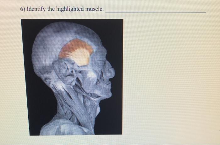 Solved 8) Identify the highlighted muscle. 7) Identify the | Chegg.com