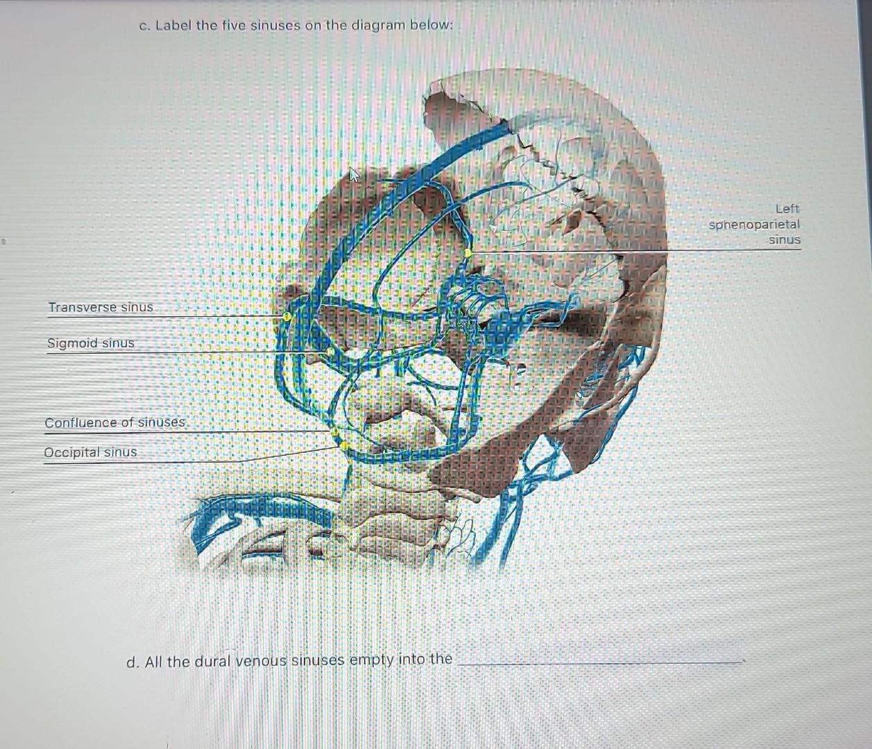 c. Label the five sinuses on the diagram below:
d. All the dural venous sinuses empty into the