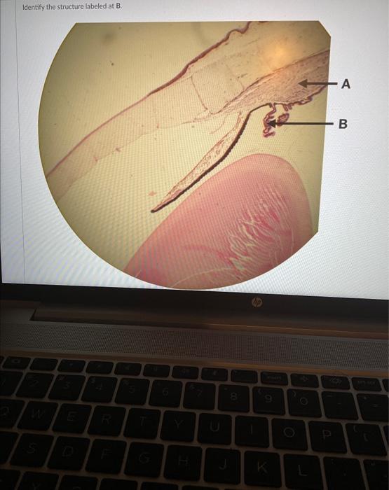 Solved Identify The Structure Labeled At B. | Chegg.com