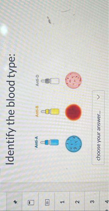 Solved 1 2 3 Identify The Blood Type: Anti-A Anti-B Choose | Chegg.com