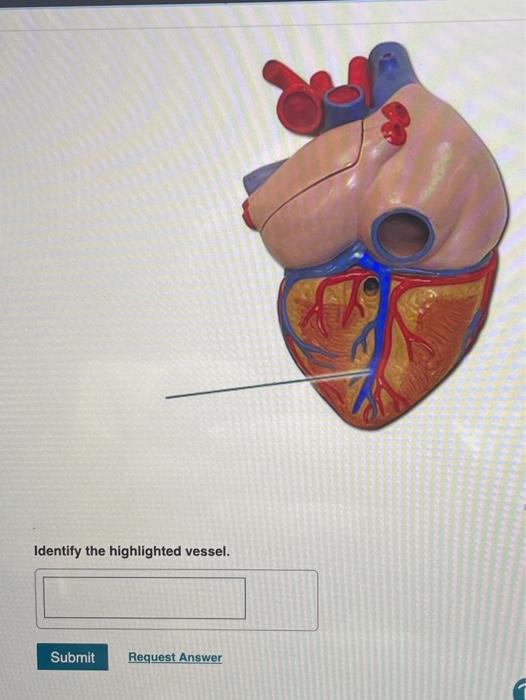 Solved Identify The Highlighted Vessel. Submit Request | Chegg.com