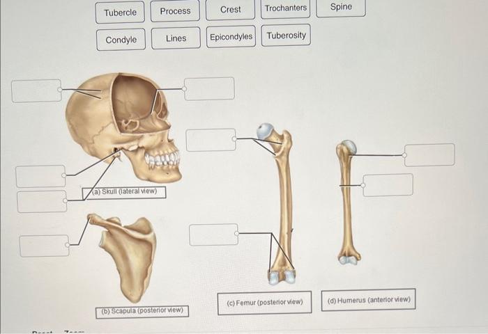 Epicondyles Tuberosity