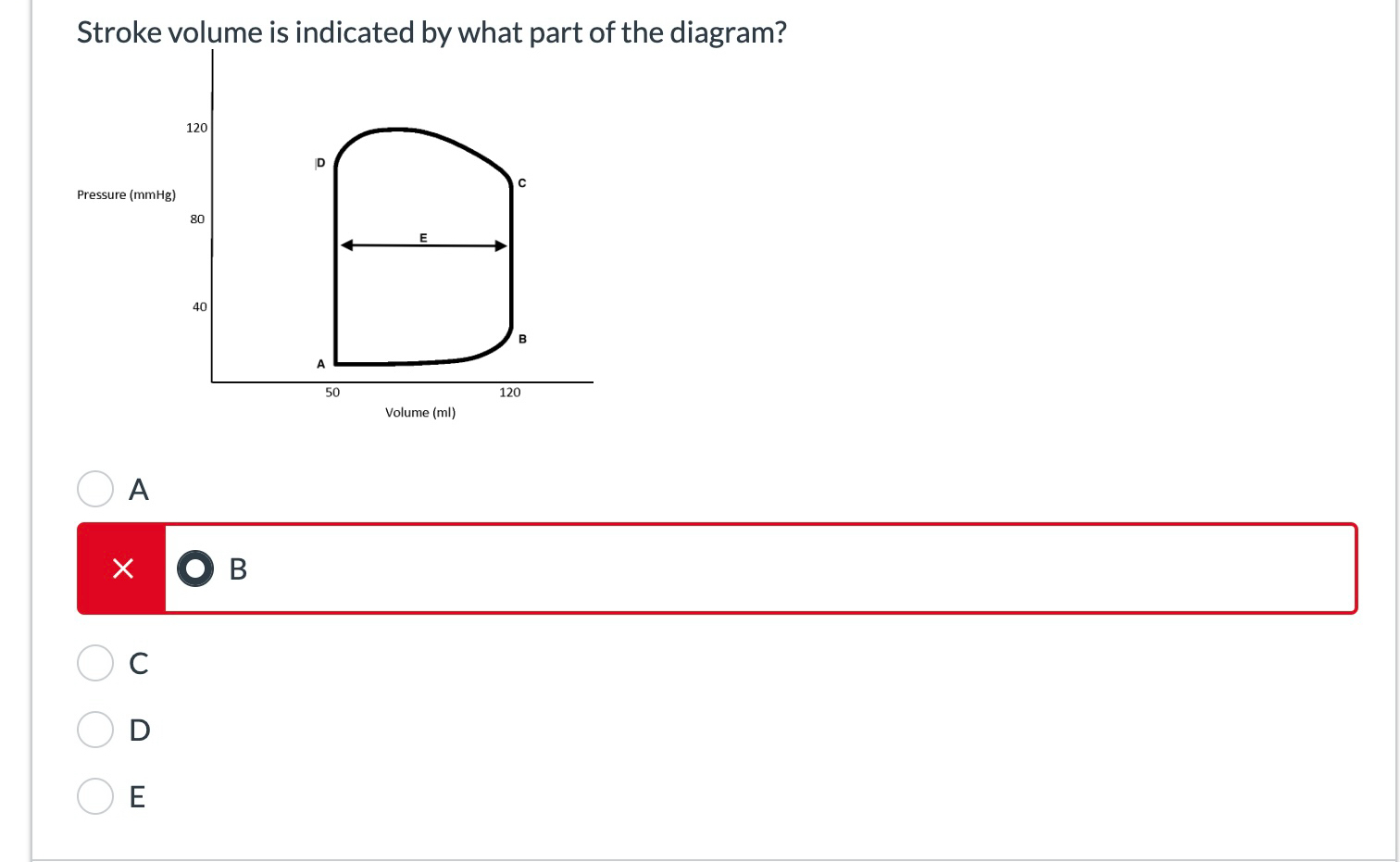 Solved Stroke volume is indicated by what part of the | Chegg.com
