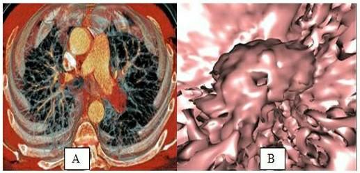 38-year-old male patient Reason for admission: | Chegg.com