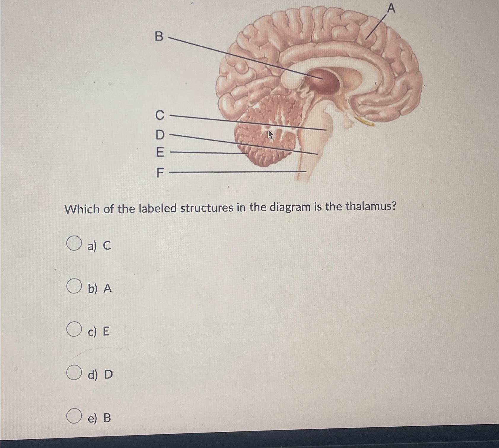Solved Which of the labeled structures in the diagram is the | Chegg.com