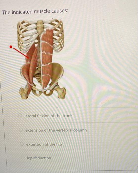 Solved The indicated muscle causes: lateral flexion of the | Chegg.com