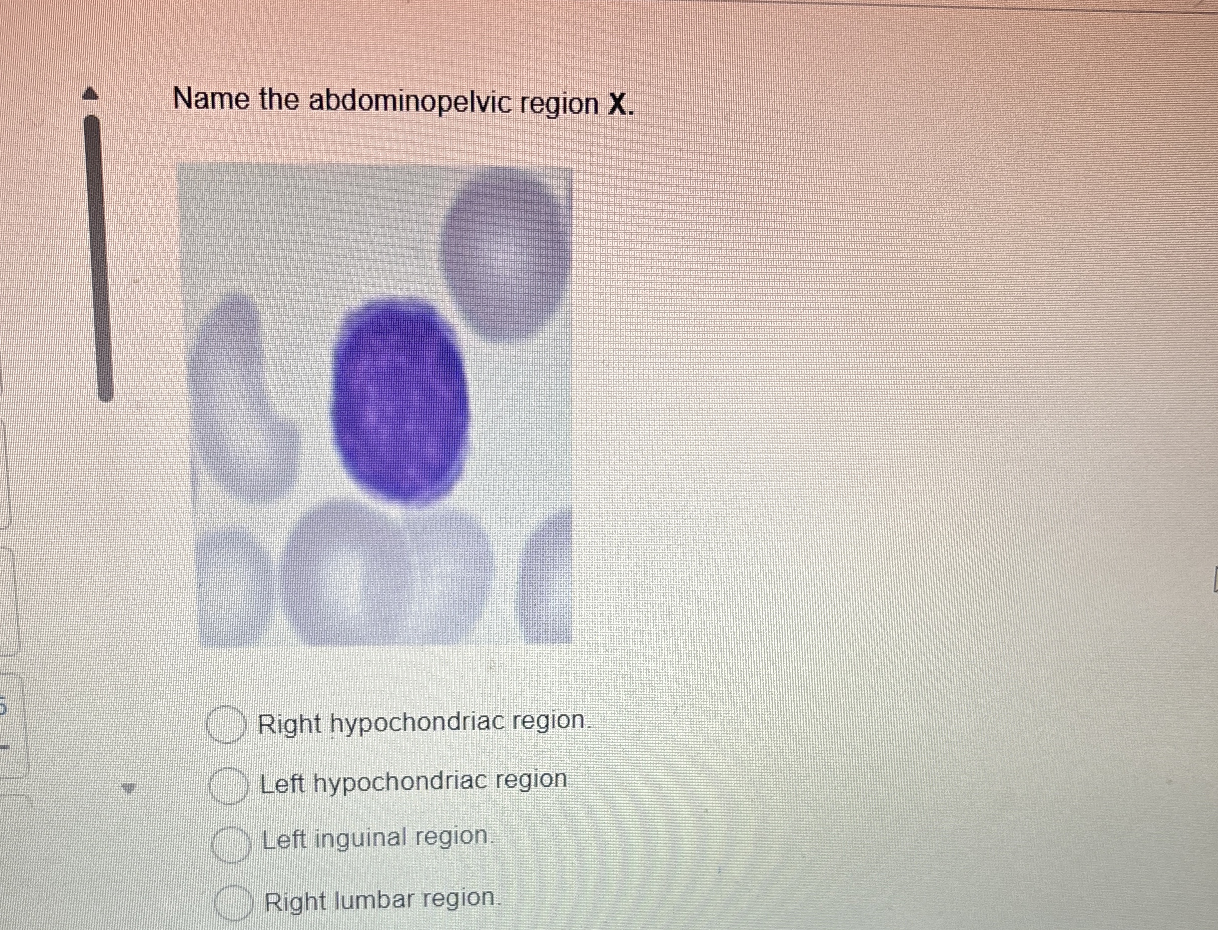 Solved Name the abdominopelvic region x.Right hypochondriac | Chegg.com