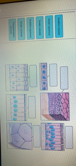 Solved Stratified cuboidal Simple squamous Simple cuboidal | Chegg.com