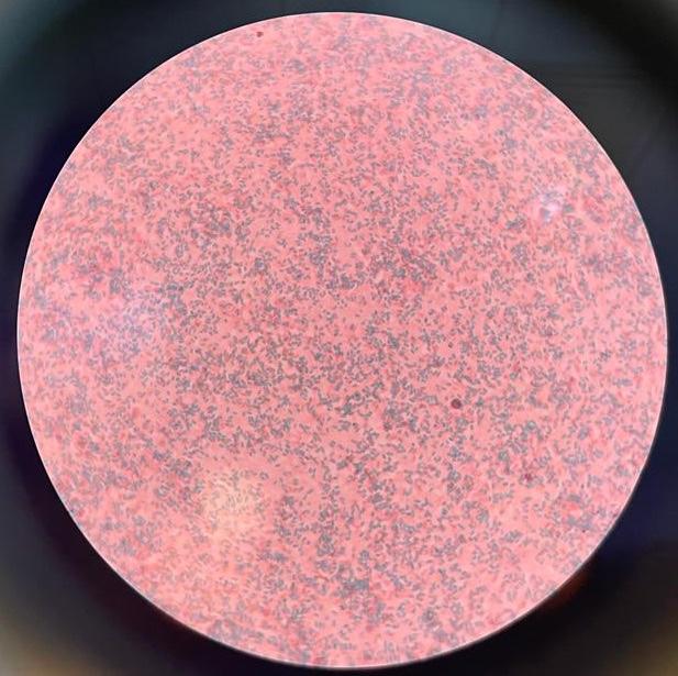 Part A. Examination of bacterial endospore by | Chegg.com