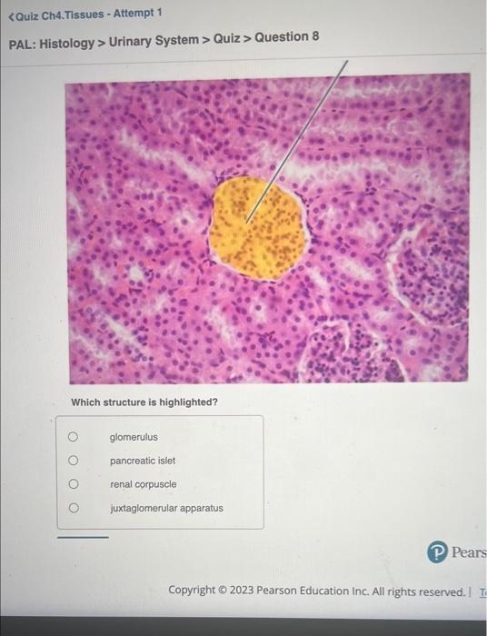 Which structure is highlighted?
glomerulus
pancreatic islet
renal corpuscle
juxtaglomerular apparatus
Copyright (c) 2023 Pear