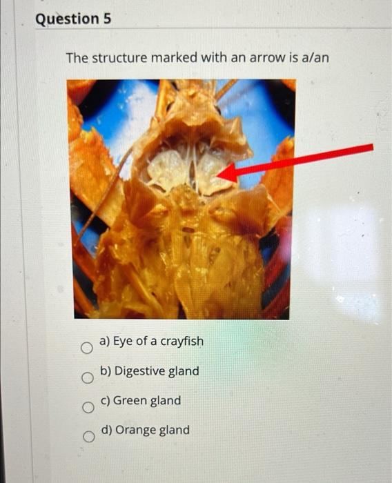 Solved Question 5 The structure marked with an arrow is alan