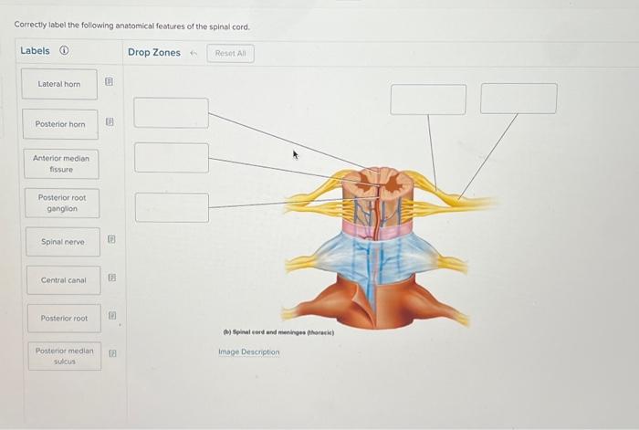 Solved Correctly label the following anatomical features of | Chegg.com