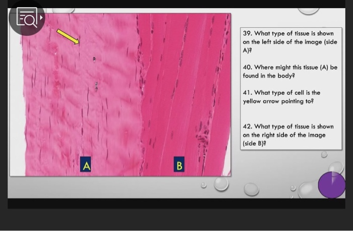 Solved B 39. What type of tissue is shown on the left side | Chegg.com