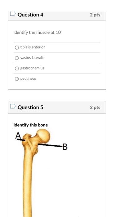 Identify the muscle at 10
tibialis anterior
vastus lateralis
gastrocnemius
pectineus
Question 5
2 pts