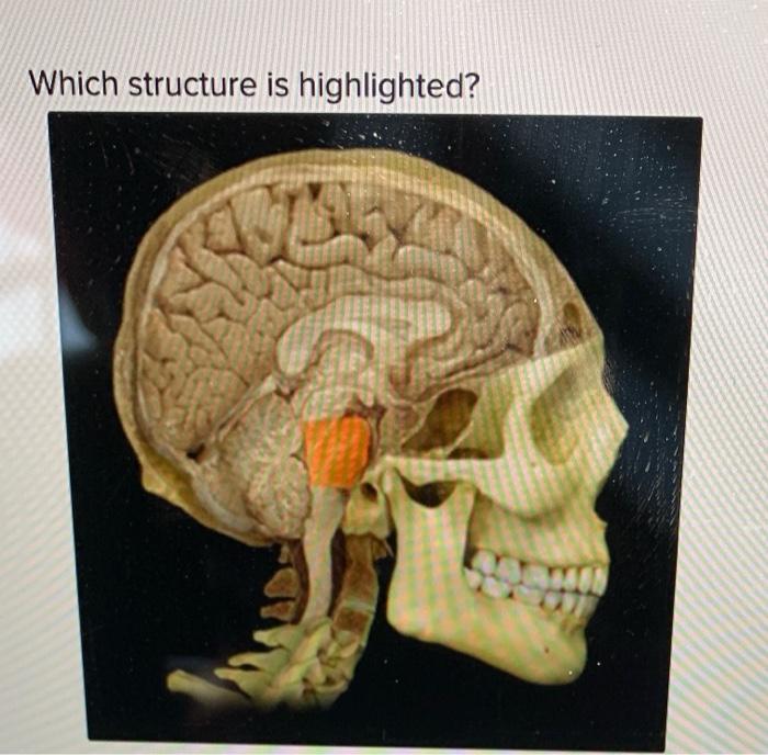 solved-which-structure-is-highlighted-chegg