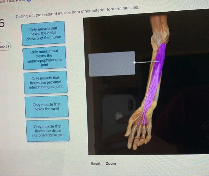 Solved am 3 (MUSIC Distinguish the featured muscle from | Chegg.com
