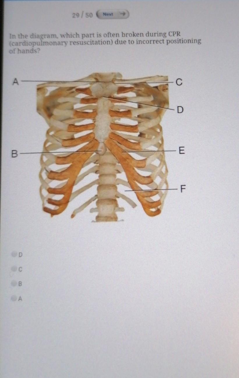 Solved 29 / 50 Next In the diagram, which part is often | Chegg.com