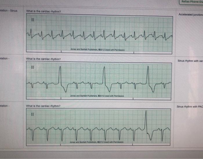 Solved Relias Phone ou tation - Sinus What is the cardiac | Chegg.com