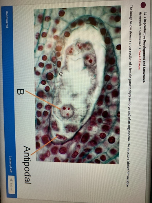 Solved 32.1 Reproductive Development And Structure4 Homework | Chegg.com