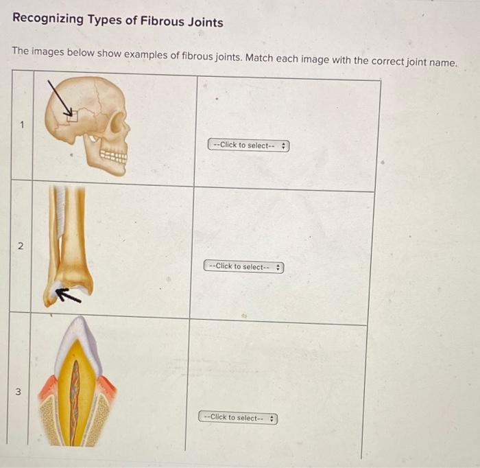 solved-recognizing-types-of-fibrous-joints-the-images-below-chegg