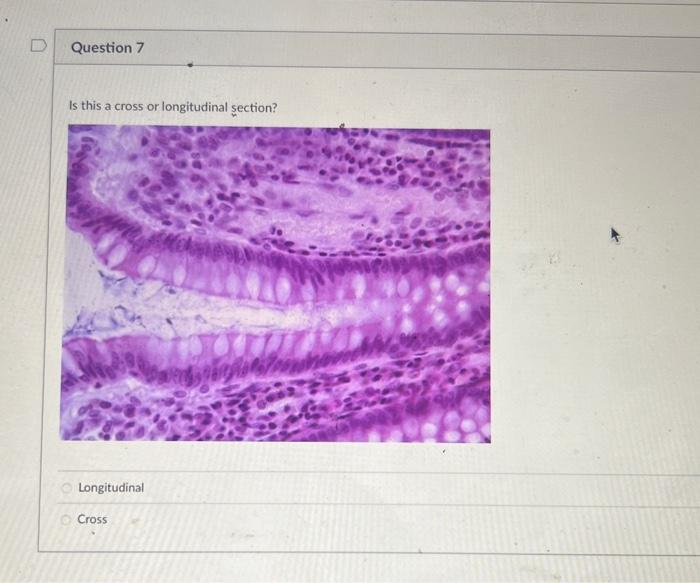 Solved Is this a cross or longitudinal section? Longitudinal | Chegg.com