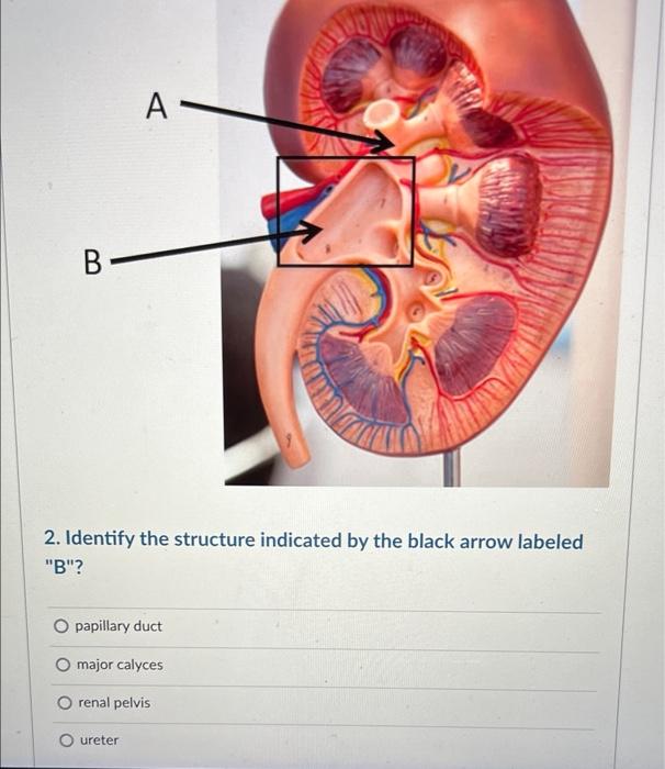 Image for question 3
