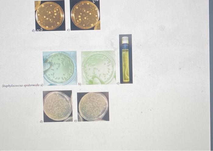 Solved *microbiology related* need help with interpretation | Chegg.com