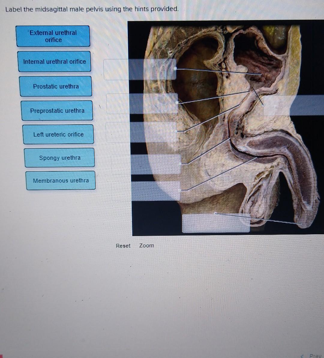 Label the midsagittal male pelvis using the hints provided.