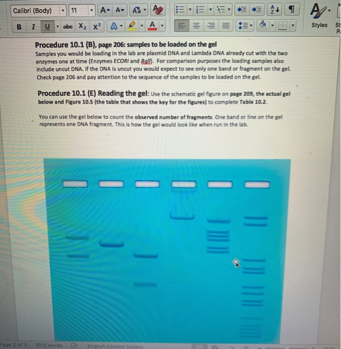 Solved Table 102 Gel Electrophoresis Results Dna Sample 9056