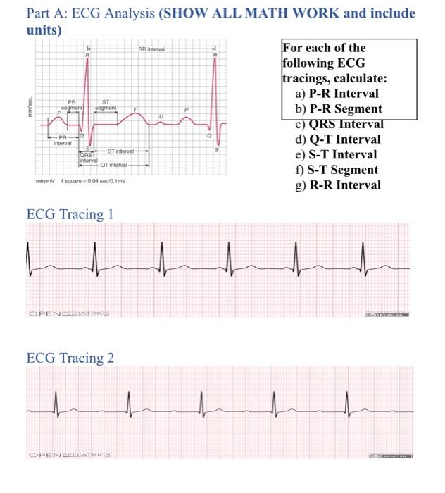 Solved RR drva R misec Part A: ECG Analysis (SHOW ALL MATH | Chegg.com