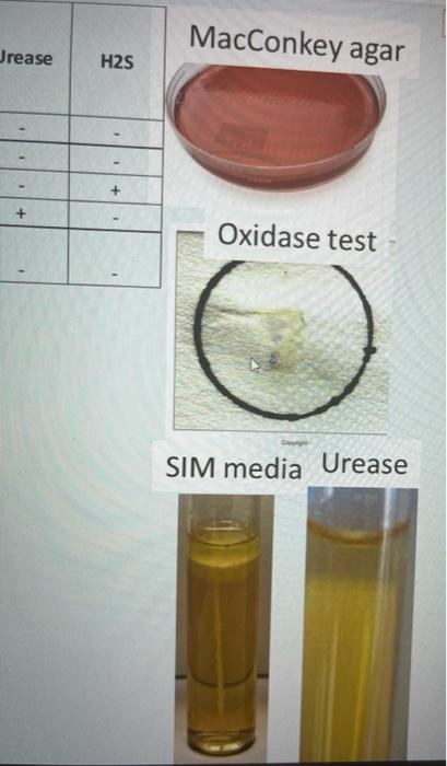 Solved MacConkey agar Jrease H2S + Oxidase test SIM media | Chegg.com