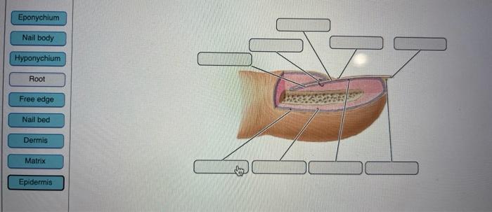 Solved Eponychium Nail body Hyponychium Root Free edge Nail | Chegg.com