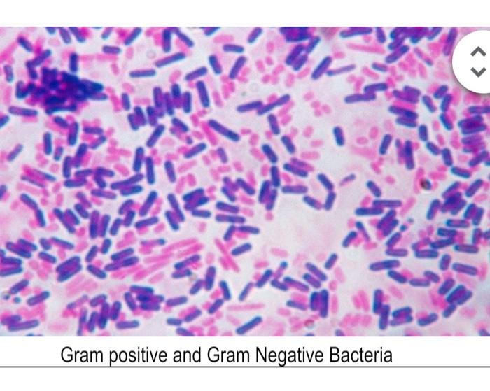 Solved : 14 Bacteria in a simple stain ASM | Chegg.com