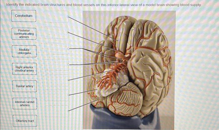 Solved Identify the indicated brain structures and blood | Chegg.com