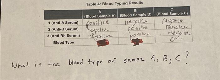 Solved B Table 4 Blood Typing Results Blood Sample A Chegg