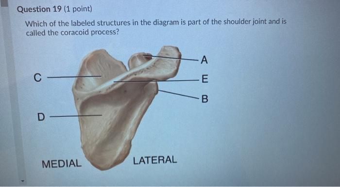 Solved Question 19 (1 point) Which of the labeled structures | Chegg.com