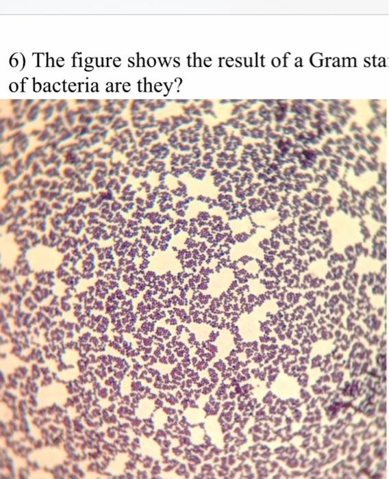 Solved 6) The figure shows the result of a Gram staining. | Chegg.com