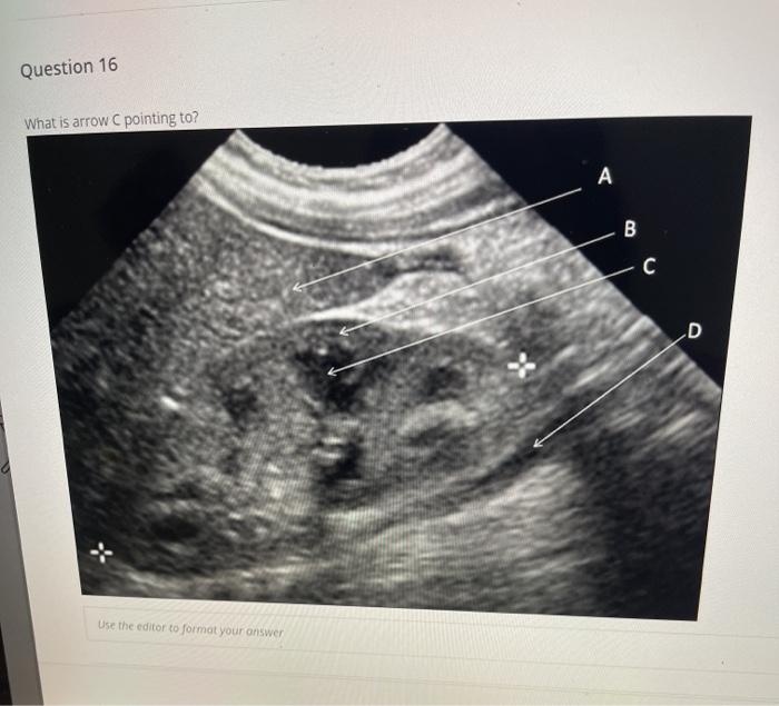 Question 16 What is arrow pointing to? A B C D Use the editor to format your answer