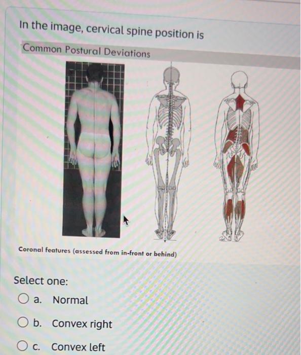 Solved In the image, cervical spine position is Common | Chegg.com