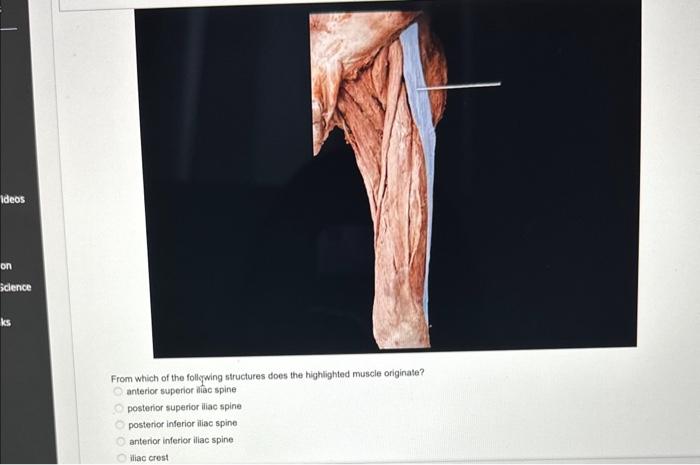 From which of the follcwing structures does the highlighted muscle originate? anterior superior aliac spine posterior superio