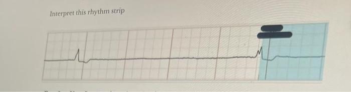 Solved Interpret This Rhythm Strip | Chegg.com