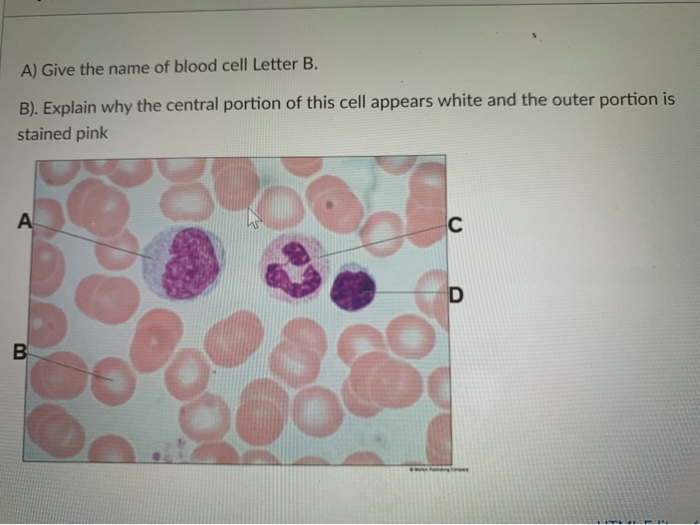 Solved A) Give The Name Of Blood Cell Letter B. B). Explain | Chegg.com