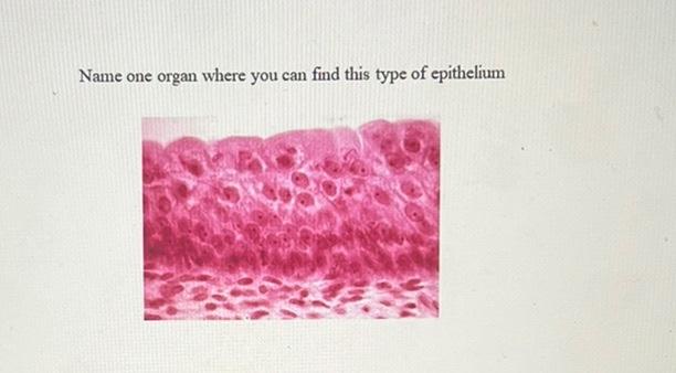 Solved Name The Structure Labeled B B Name One Organ Where | Chegg.com