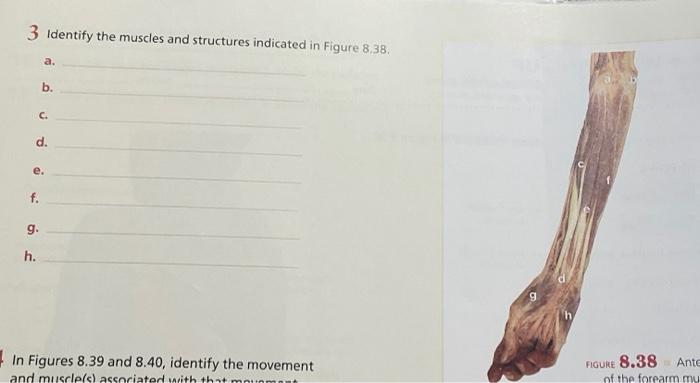 Solved 3 Identify the muscles and structures indicated in | Chegg.com