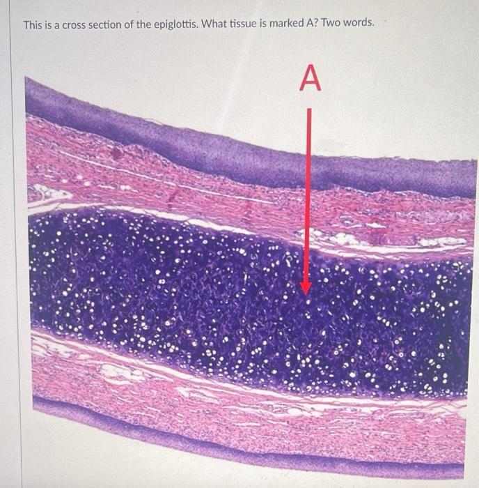 Solved This is a cross section of the epiglottis. What | Chegg.com