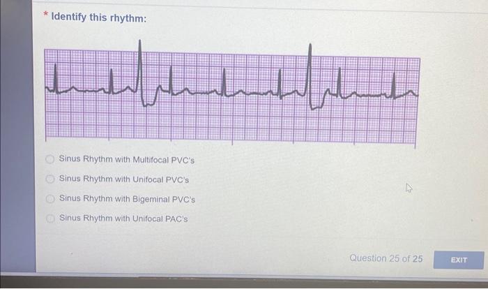 Solved * Identify this rhythm: Sinus Rhythm with Multifocal | Chegg.com