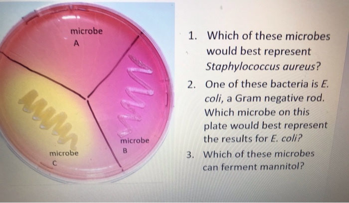 Solved Microbe A 1 Which Of These Microbes Would Best Re Chegg Com
