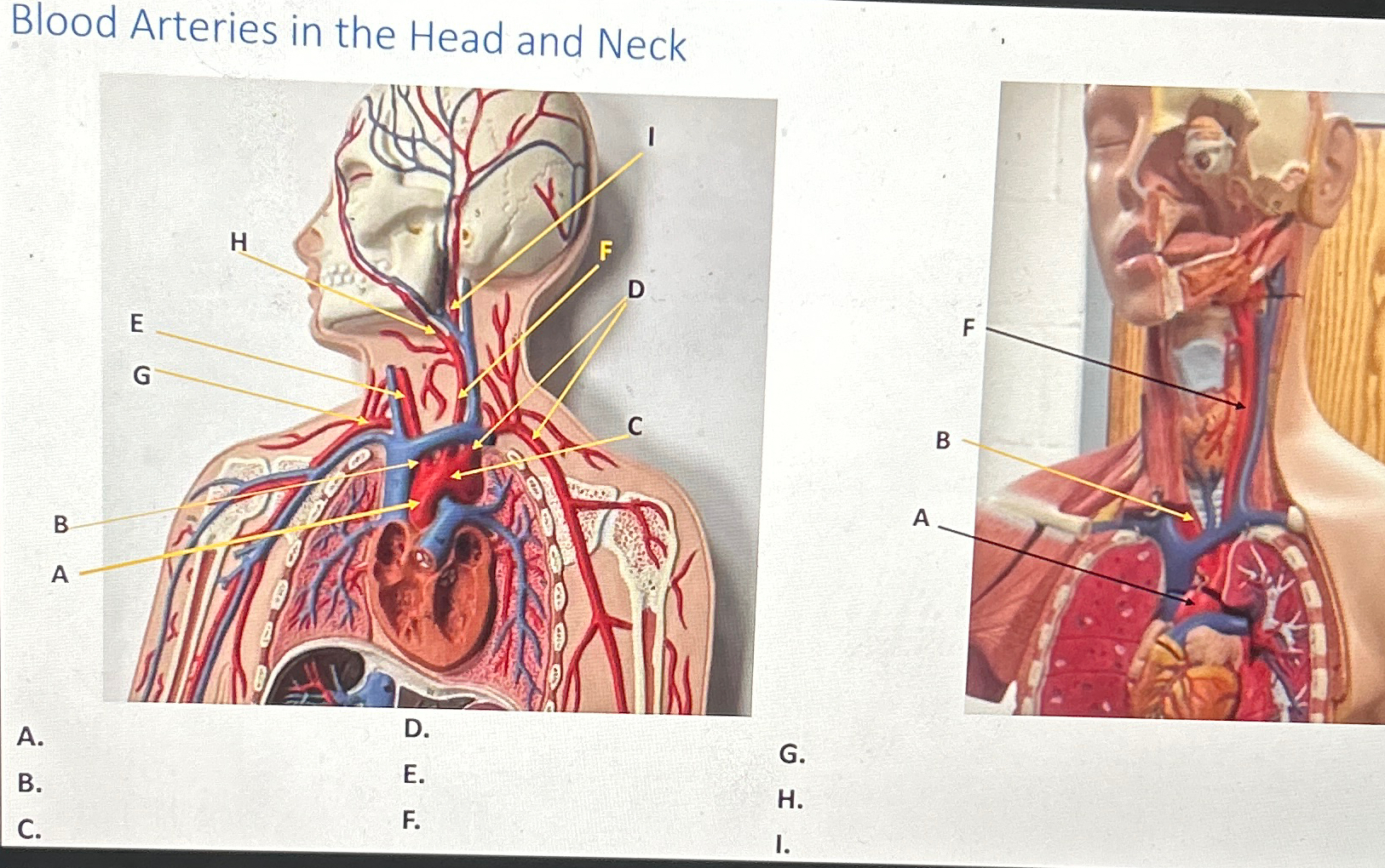 Solved Blood Arteries in the Head and ninal.1G.!H.C.r.I. | Chegg.com